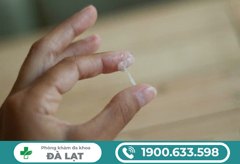 Hình ảnh minh họa